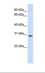 Jurkat cell lysate. Antibody concentration: 1.0 ug/ml. Gel concentration: 12%.