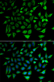 Immunofluorescence analysis of HeLa cell using SLC25A20 antibody. Blue: DAPI for nuclear staining.