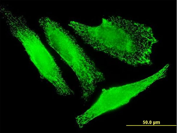 Immunofluorescence of monoclonal antibody to SLC25A20 on HeLa cell . [antibody concentration 10 ug/ml]