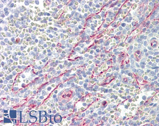 Anti-SLC25A21 / ODC antibody IHC of human spleen. Immunohistochemistry of formalin-fixed, paraffin-embedded tissue after heat-induced antigen retrieval. Antibody LS-B8566 dilution 5 ug/ml.