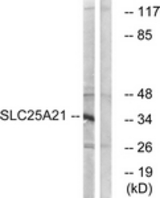 Western blot of extracts from HepG2 cells, using SLC25A21 Antibody. The lane on the right is treated with the synthesized peptide.
