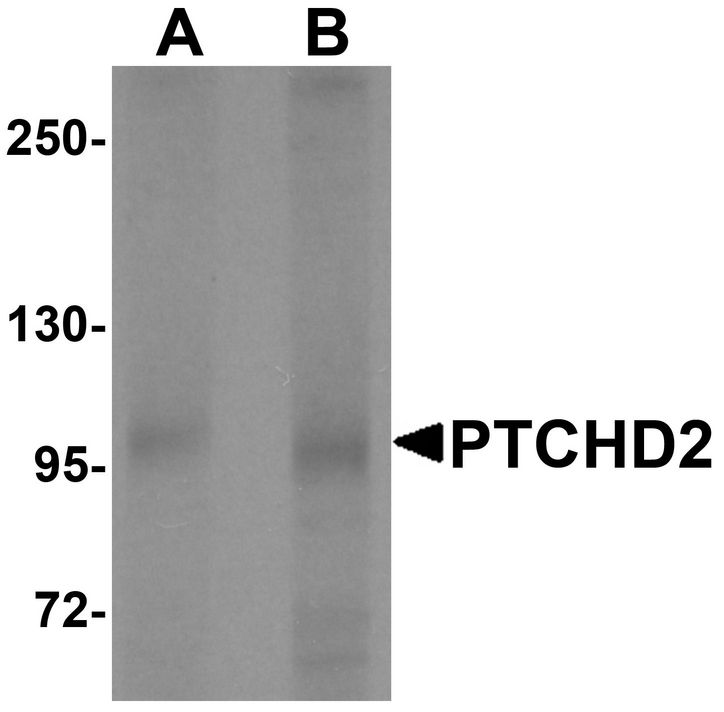 Western blot analysis of PTCHD2 in mouse kidney tissue lysate with PTCHD2 antibody at (A) 1 and (B) 2 ug/ml.