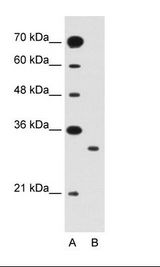 A: Marker, B: Jurkat Cell Lysate