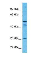 Western blot of SCMC1 Antibody with human MCF7 Whole Cell lysate.