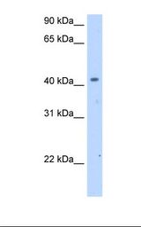 Fetal Thymus cell lysate. Antibody concentration: 2.5 ug/ml. Gel concentration: 12%.