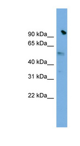 SLC25A25 antibody LS-C116254 Western blot of HepG2 cell lysate.