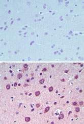IHC ofUCP4 in paraffin-embedded formalin-fixed rat brain tissue using an isotype control (top) and LS-C148475 (bottom) at 5 ug/ml.