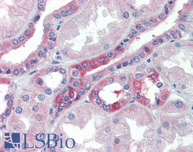 Anti-SLC25A28 antibody IHC of human kidney. Immunohistochemistry of formalin-fixed, paraffin-embedded tissue after heat-induced antigen retrieval. Antibody LS-B3556 concentration 5 ug/ml.