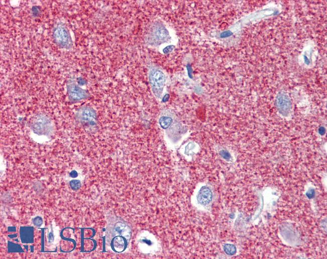 Anti-SLC25A28 antibody IHC of human brain, cortex. Immunohistochemistry of formalin-fixed, paraffin-embedded tissue after heat-induced antigen retrieval. Antibody LS-B3556 concentration 5 ug/ml.