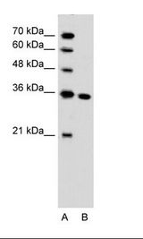 A: Marker, B: Jurkat Cell Lysate