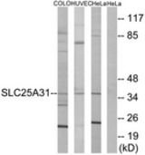 Western blot of extracts from HeLa/HUVEC/COLO cells, using SLC25A31 Antibody. The lane on the right is treated with the synthesized peptide.