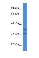 SLC25A31 antibody LS-C135308 Western blot of Mouse Heart lysate. Antibody concentration 1 ug/ml.