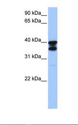 Fetal brain lysate. Antibody concentration: 1.0 ug/ml. Gel concentration: 12%.