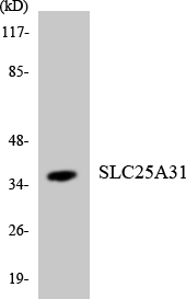 Western blot of the lysates from K562 cells using SLC25A31 antibody.
