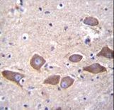 SLC25A31 Antibody immunohistochemistry of formalin-fixed and paraffin-embedded human brain tissue followed by peroxidase-conjugated secondary antibody and DAB staining.