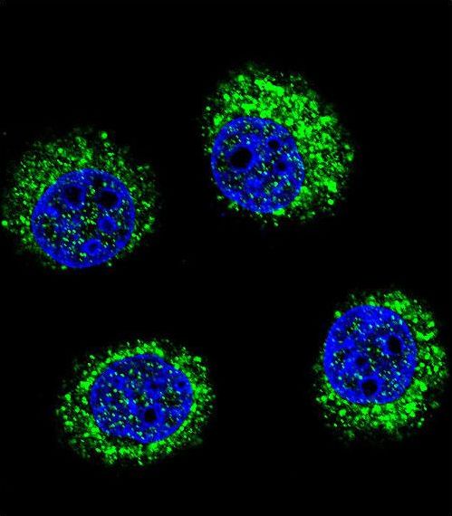 Confocal immunofluorescent of SLC25A31 Antibody with U-251MG cell followed by Alexa Fluor 488-conjugated goat anti-rabbit lgG (green). DAPI was used to stain the cell nuclear (blue).