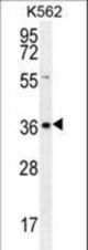SLC25A31 Antibody western blot of K562 cell line lysates (35 ug/lane). The SLC25A31 antibody detected the SLC25A31 protein (arrow).