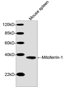 Western blot of tissue lysates using Mitoferrin-1 Antibody, pAb, Rabbit (LS-C51646, 1 ug/ml) The signal was developed with Goat Anti-Rabbit IgG (H&L) [HRP] Polyclonal Antibody and LumiSensor HRP Substrate Kit Predicted Size: 38 kD Observed Size: 38 kD