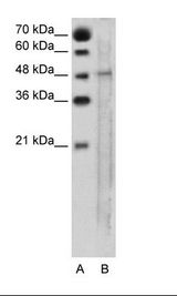 A: Marker, B: Jurkat Cell Lysate