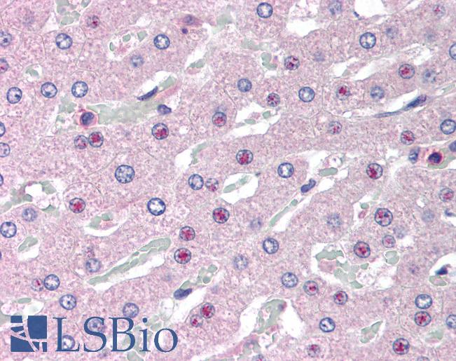 Anti-SLC25A47 / C14orf68 antibody IHC of human liver. Immunohistochemistry of formalin-fixed, paraffin-embedded tissue after heat-induced antigen retrieval. Antibody LS-B1743 concentration 5 ug/ml.