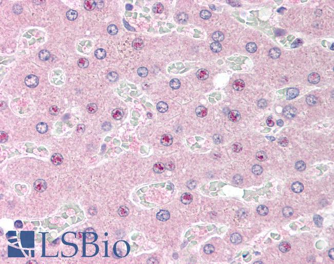Anti-SLC25A47 / C14orf68 antibody IHC of human liver. Immunohistochemistry of formalin-fixed, paraffin-embedded tissue after heat-induced antigen retrieval. Antibody LS-B1742 concentration 5 ug/ml.
