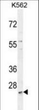 MCART2 Antibody western blot of K562 cell line lysates (35 ug/lane). The MCART2 antibody detected the MCART2 protein (arrow).