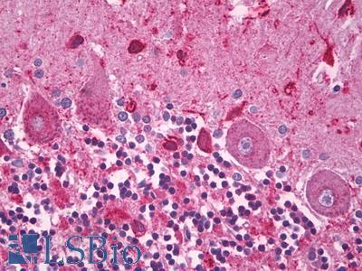Anti-SLC25A6 / ANT3 antibody IHC of human brain, cerebellum. Immunohistochemistry of formalin-fixed, paraffin-embedded tissue after heat-induced antigen retrieval. Antibody LS-B8181 dilution 5 ug/ml.