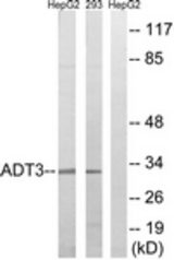 Western blot of extracts from HepG2/293 cells, using SLC25A6 Antibody. The lane on the right is treated with the synthesized peptide.