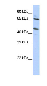 SLC26A10 antibody LS-C101797 Western blot of HepG2 cell lysate.