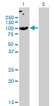 Western Blot analysis of SLC26A2 expression in transfected 293T cell line by SLC26A2 monoclonal antibody (M04), clone 3F6.Lane 1: SLC26A2 transfected lysate(81.6 KDa).Lane 2: Non-transfected lysate.
