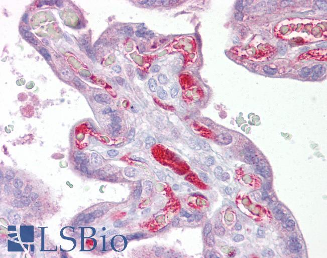 Anti-SLC26A4 antibody IHC of human placenta. Immunohistochemistry of formalin-fixed, paraffin-embedded tissue after heat-induced antigen retrieval. Antibody LS-B6627 concentration 5 ug/ml.