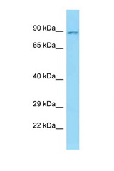 SLC26A6 antibody LS-C146115 Western blot of PANC1 Cell lysate. Antibody concentration 1 ug/ml.