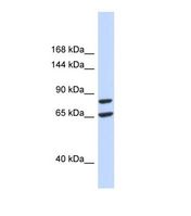 Western blot of Human 293T. SLC26A8 antibody dilution 1.0 ug/ml.
