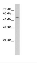 Jurkat Cell Lysate