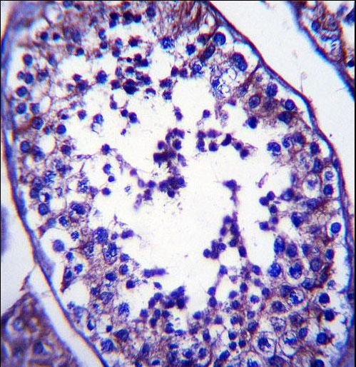SLC27A3 Antibody immunohistochemistry of formalin-fixed and paraffin-embedded human testis tissue followed by peroxidase-conjugated secondary antibody and DAB staining.