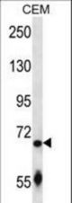 SLC27A3 Antibody western blot of CEM cell line lysates (35 ug/lane). The SLC27A3 antibody detected the SLC27A3 protein (arrow).