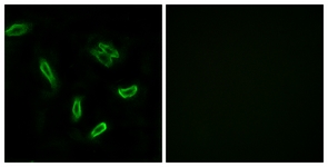 Immunofluorescence of A549 cells, using SLC27A5 Antibody. The picture on the right is treated with the synthesized peptide.