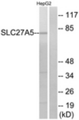 Western blot of extracts from HepG2 cells, using SLC27A5 Antibody. The lane on the right is treated with the synthesized peptide.
