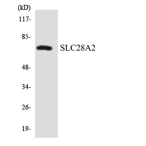 Western blot of the lysates from HepG2 cells using SLC28A2 antibody.