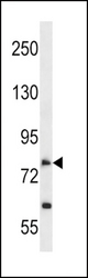 SLC28A2 Antibody western blot of A549 cell line lysates (35 ug/lane). The SLC28A2 antibody detected the SLC28A2 protein (arrow).