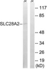 Western blot of extracts from Jurkat cells, using SLC28A2 Antibody. The lane on the right is treated with the synthesized peptide.