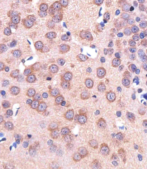 Immunohistochemical of paraffin-embedded R. brain section using ENT1(Slc29a1). Antibody was diluted at 1:25 dilution. A peroxidase-conjugated goat anti-rabbit IgG at 1:400 dilution was used as the secondary antibody, followed by DAB staining.