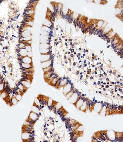Immunohistochemical of paraffin-embedded H. colon section using ENT1(Slc29a1). Antibody was diluted at 1:25 dilution. A peroxidase-conjugated goat anti-rabbit IgG at 1:400 dilution was used as the secondary antibody, followed by DAB staining.