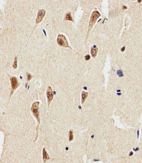 Immunohistochemical of paraffin-embedded H. brain section using ENT1(Slc29a1). Antibody was diluted at 1:25 dilution. A peroxidase-conjugated goat anti-rabbit IgG at 1:400 dilution was used as the secondary antibody, followed by DAB staining.