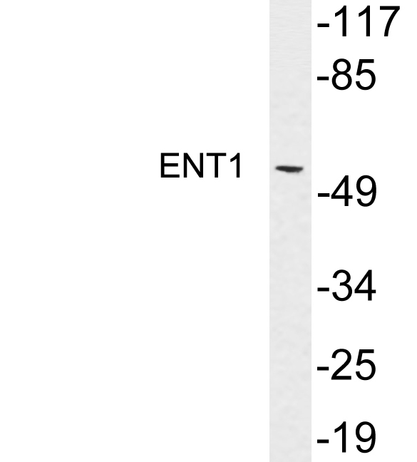 Western blot of extracts from MDA-MB-435 cells, using ENT1 antibody.