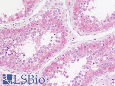 Testis, Human: Formalin-Fixed, Paraffin-Embedded (FFPE)