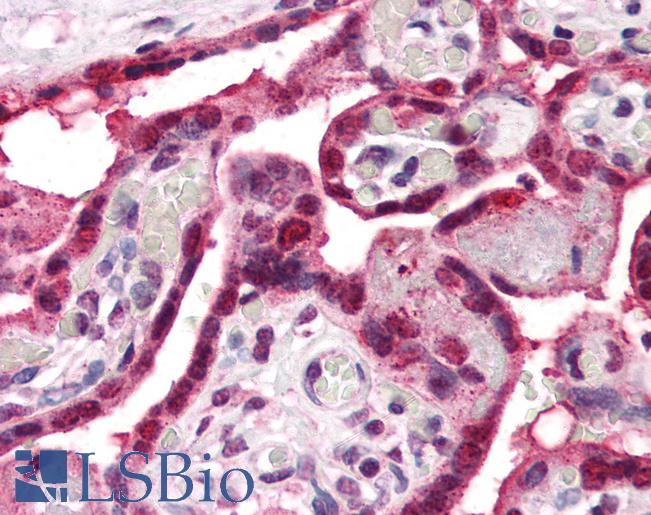 Anti-ENT1 antibody LS-A9777 IHC of human placenta. Immunohistochemistry of formalin-fixed, paraffin-embedded tissue after heat-induced antigen retrieval.