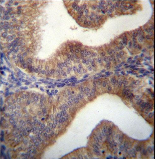SLC29A3 Antibody immunohistochemistry of formalin-fixed and paraffin-embedded human uterus tissue followed by peroxidase-conjugated secondary antibody and DAB staining.