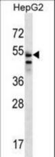 SLC29A3 Antibody western blot of HepG2 cell line lysates (35 ug/lane). The SLC29A3 antibody detected the SLC29A3 protein (arrow).