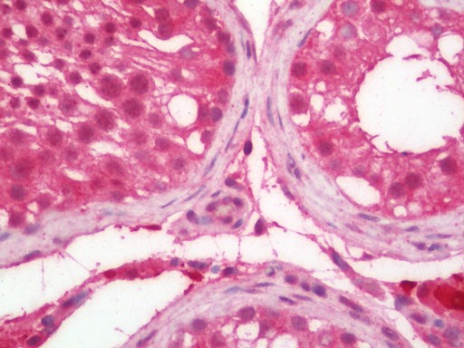 Human Testis: Formalin-Fixed, Paraffin-Embedded (FFPE)